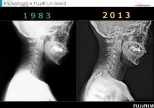 初期のFCR画像と最新のFCR画像比較